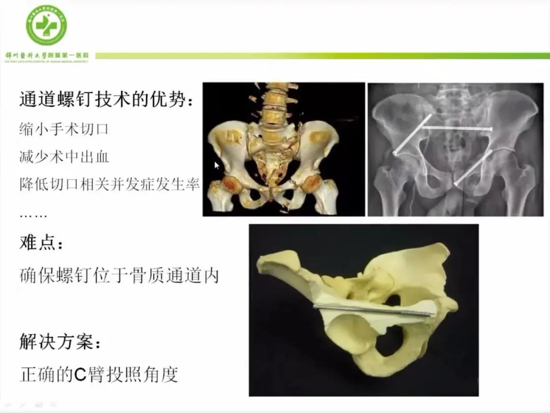 聚焦顯微外科|葫蘆島市醫(yī)學(xué)會顯微外科學(xué)分會第一屆第二次學(xué)術(shù)會議順利召開(圖11)